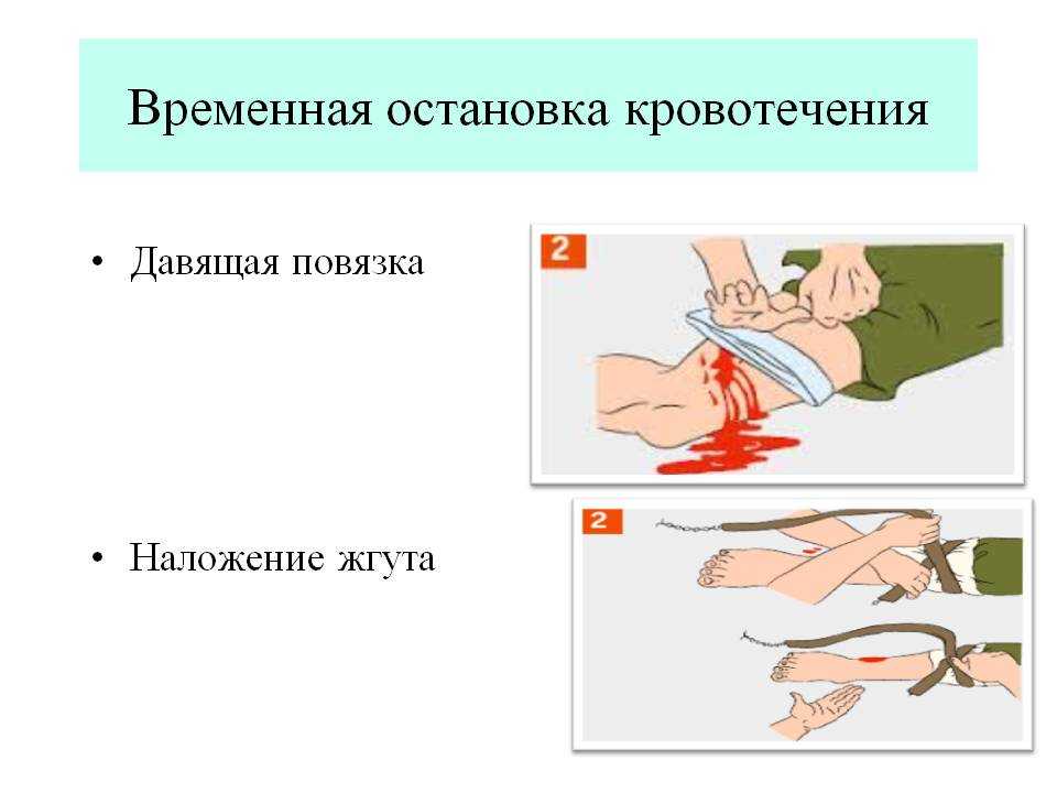 Как правильно оказать первую помощь, если взрослый или ребенок проколол ногу ржавым гвоздем, что делать и чем лечить, если после прокола нога стала опухать.
